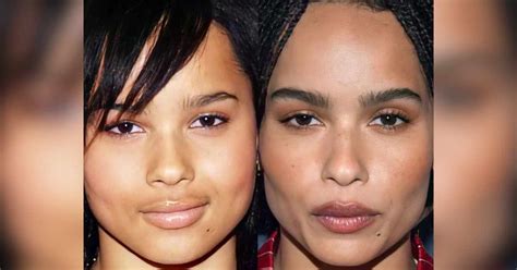 zoe kravitz plastic surgery|Zoe Kravitz Plastic Surgery Speculations: Unraveling。